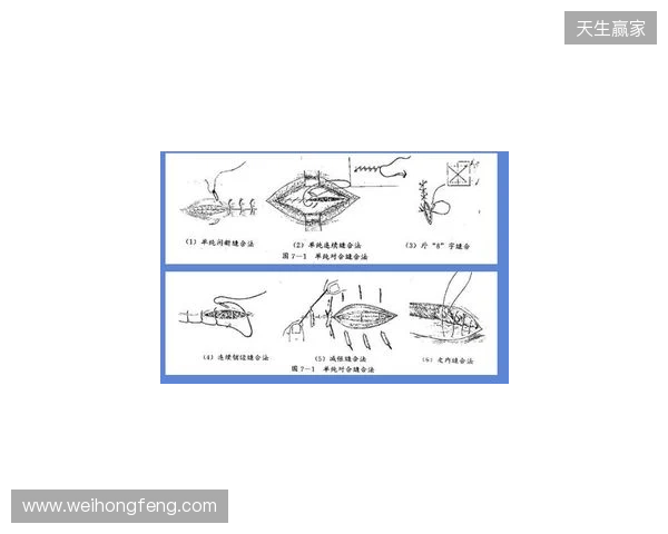 广州豹官方:杨浩眉弓伤口缝合30余针,预计5-7天后拆线 广州豹官方:杨浩眉弓伤口缝合30余针,预计5-7天后拆线